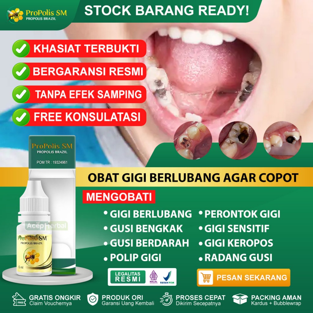 Obat Gigi Berlubang Agar Copot Polip Gigi Gigi Sensitif Gigi Keropos Gusi Bengkak Gusi Berdarah Prop