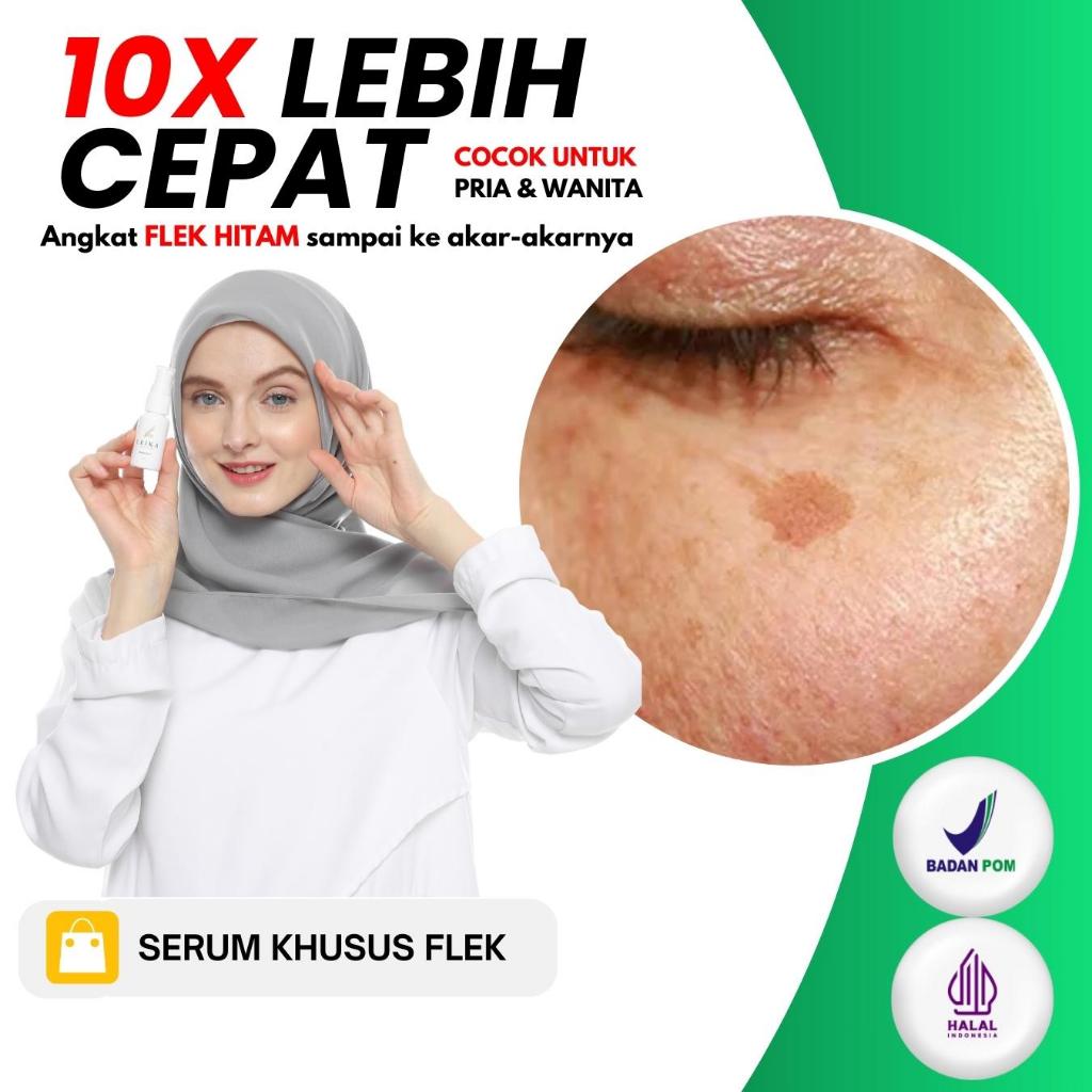 SERUM KHUSUS FLEK HITAM MEMBANDEL BPOM Serum yang di formulasikan khusus untuk mengatasi flek hitam 