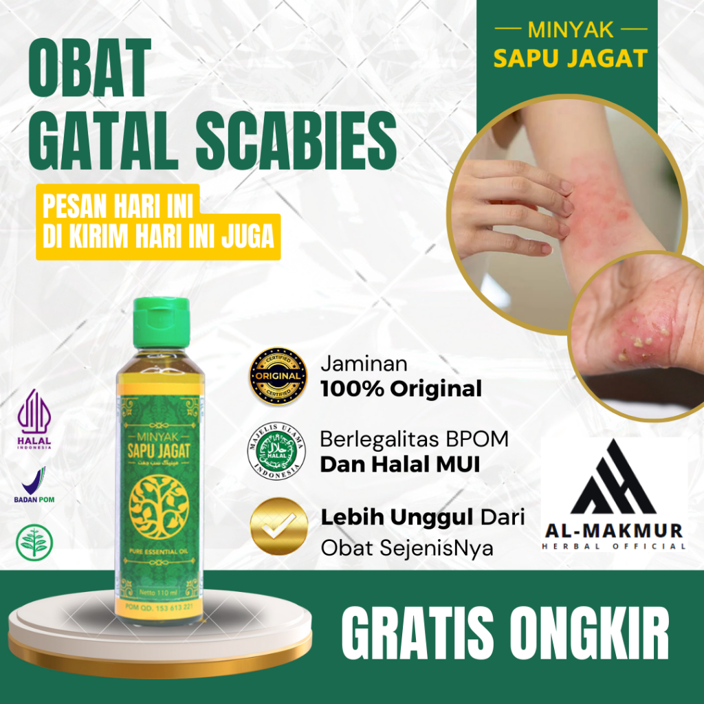 Obat Scabies, Obat Kudis, Obat Gatal Scabies, Obat Budug, Obat Gatal Bernanah, Obat Gigitan Tungau, 