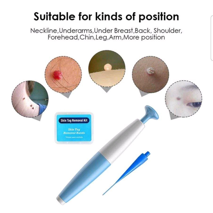 kutilat remover ORIGINAL