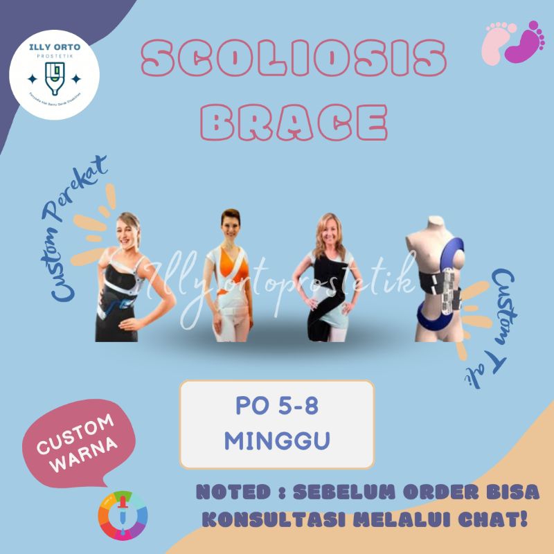 SCOLIOSIS BRACE