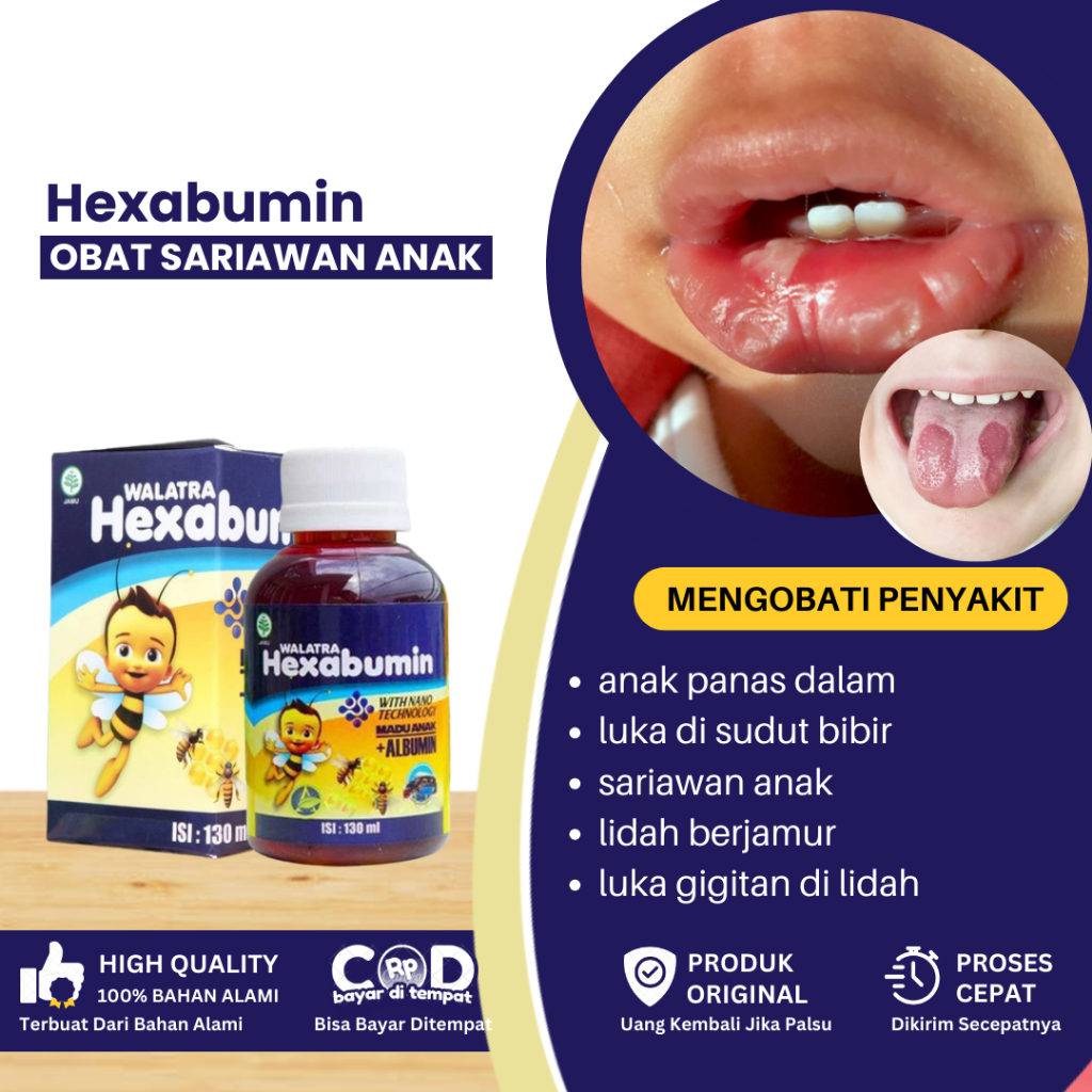 Obat Sariawan Anak, Obat Panas Dalam, Obat Luka Di Sudut Bibir, Obat Bibir Pecah Pecah Anak, Bibir A
