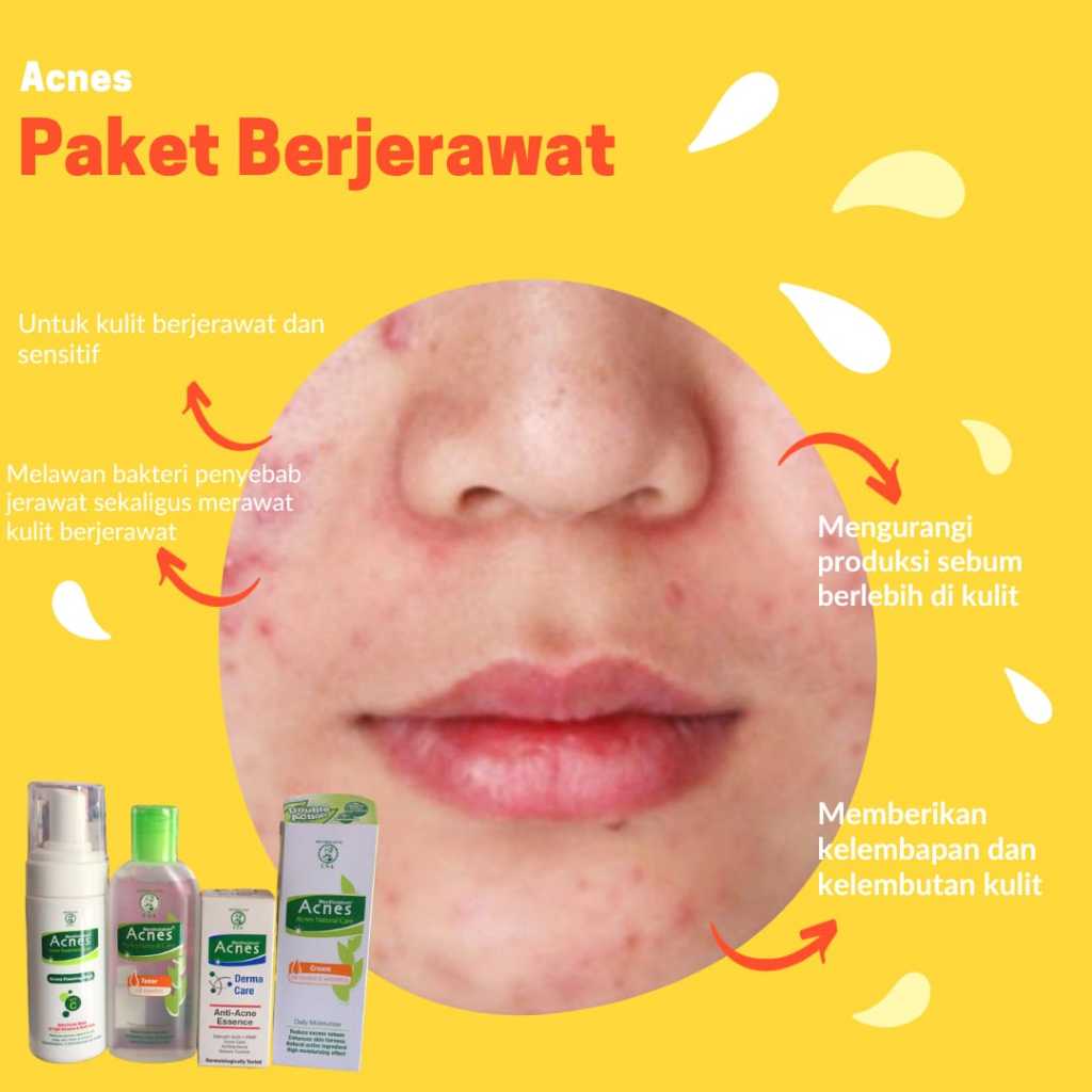 Acnes Paket Berjerawat