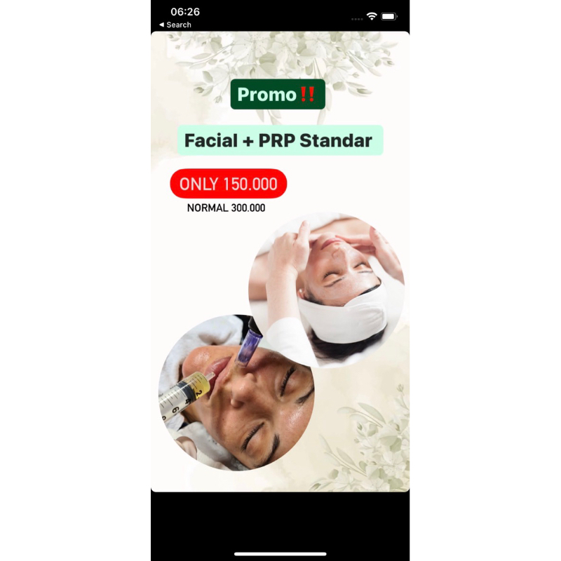 PRP standard treatment