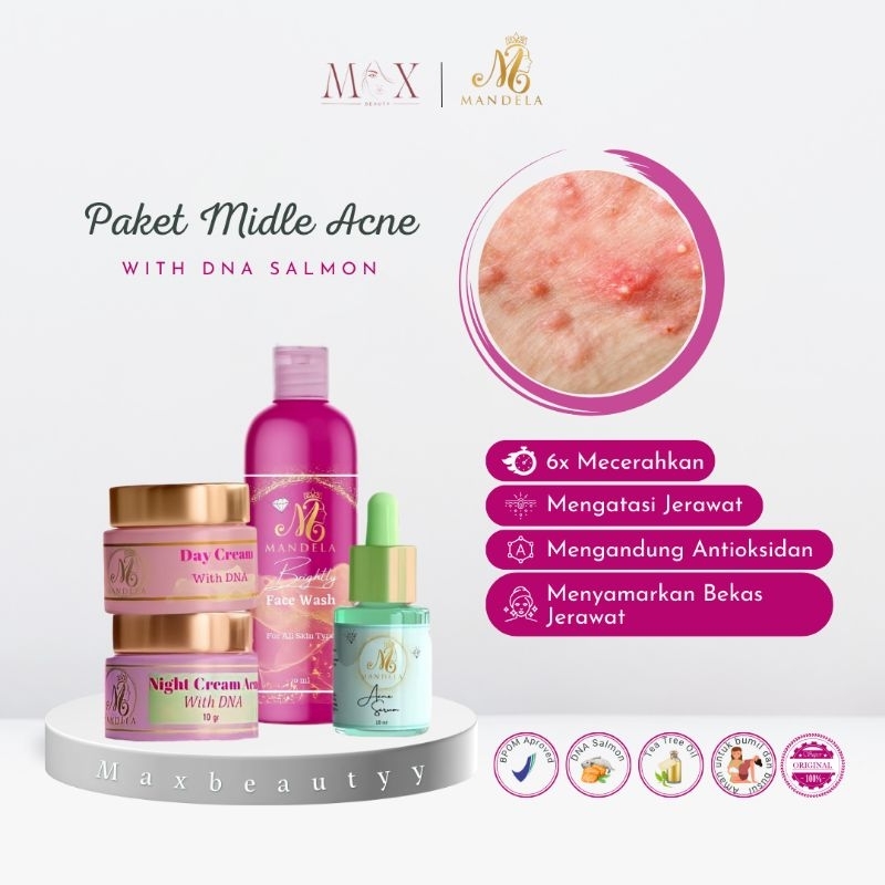 MBC MANDELA BEAUTY CARE PAKET MIDDLE ACNE MENGATASI JERAWAT BERUNTUS | ISI 4 ITEM