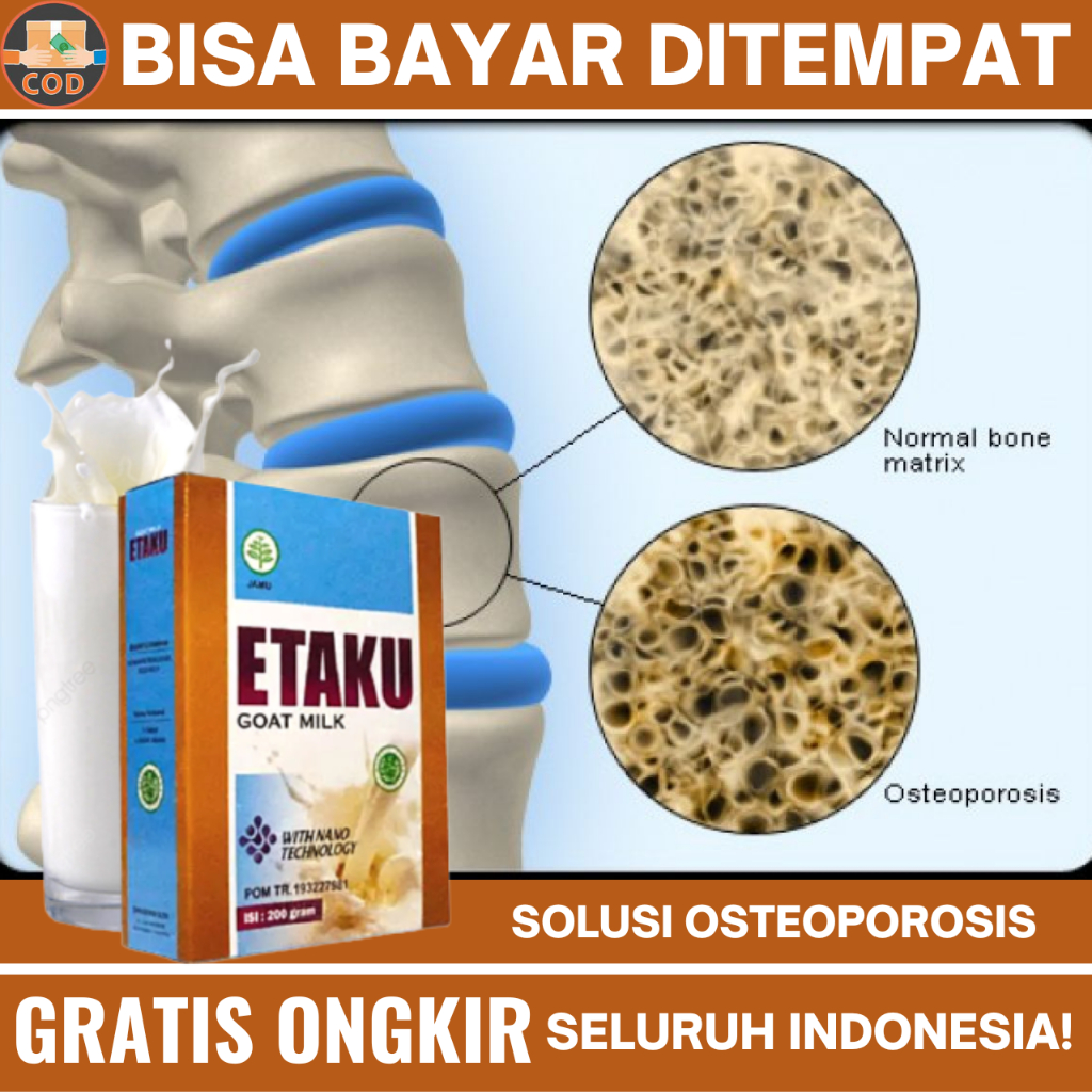 

Susu atasi Osteoporosis, Obat Pengapuran Tulang, Obat Nyeri Sendi dan Tulang, Obat Tulang Keropos, Obat Nyeri Tulang Belakang, Obat Radang Sendi, Obat Kesehatan Tulang, Susu Tinggi Kalsium, Obat Nyeri Pinggang dan Punggung, Obat Nyeri Tulang Lutut, Etaku