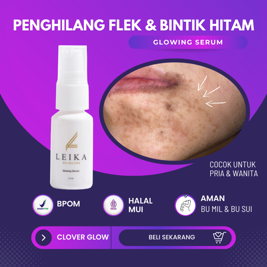 Serum Flek Hitam Membandel Glowing Serum Penghilang Flek Hitam Di Wajah Untuk Menghilangkan Flek Hit