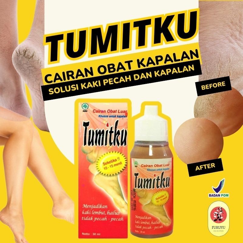 TUMITKU MENGATASI KAKI PECAH 30ML / TUMITKU OBAT HERBAL MENGATASI KAKI PECAH PECAH KAPALAN / Tumitku