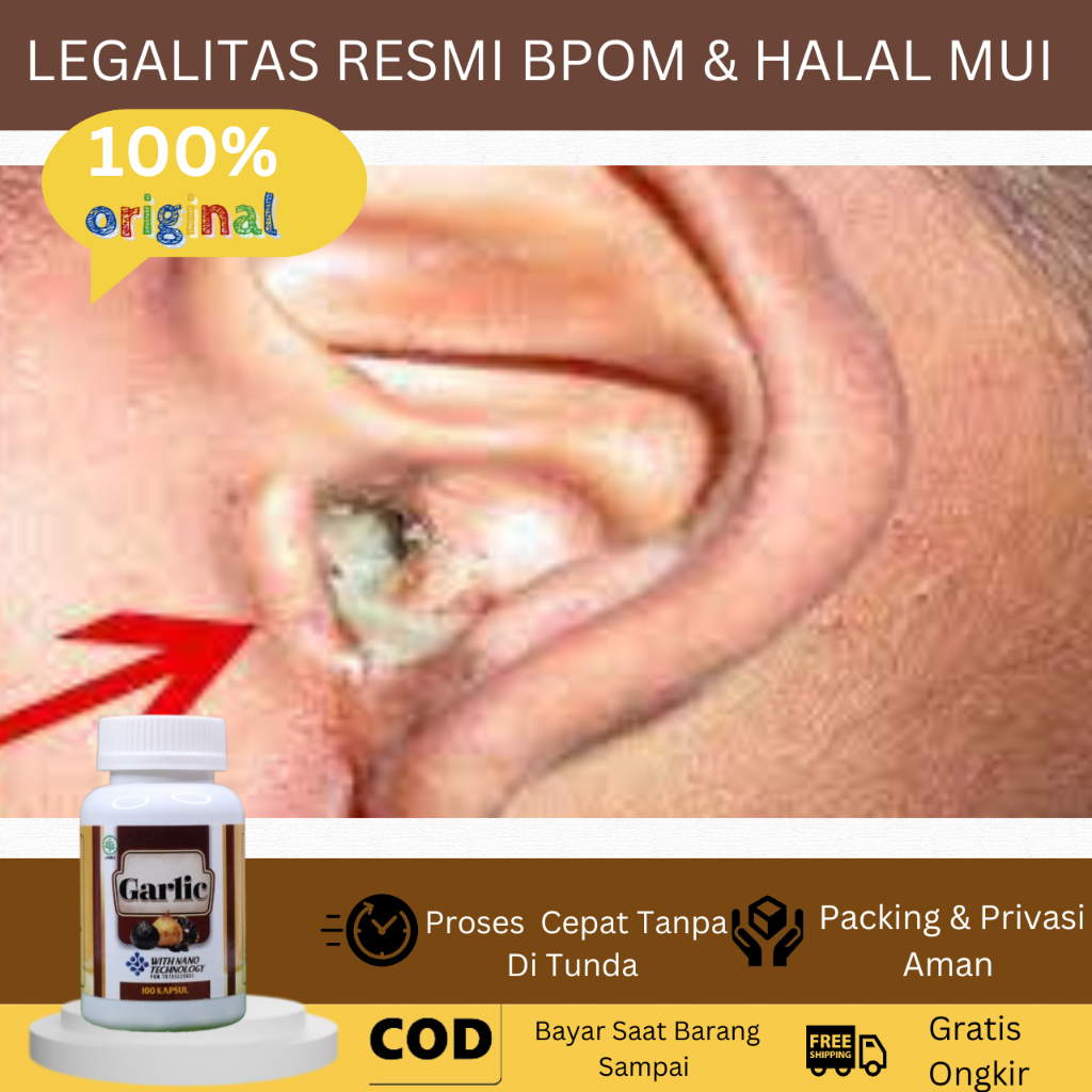 Obat Herbal Telinga Berdenging Obat Herbal Telinga Berdenging Obat Telinga Berair Obat Telinga Berna