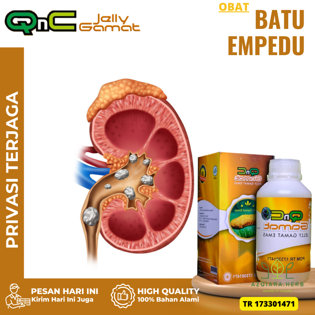 Obat Batu Empedu, Obat Penghancur Batu Empedu, Obat Herbal Penghancur Batu Empedu, Obat Peluruh Batu