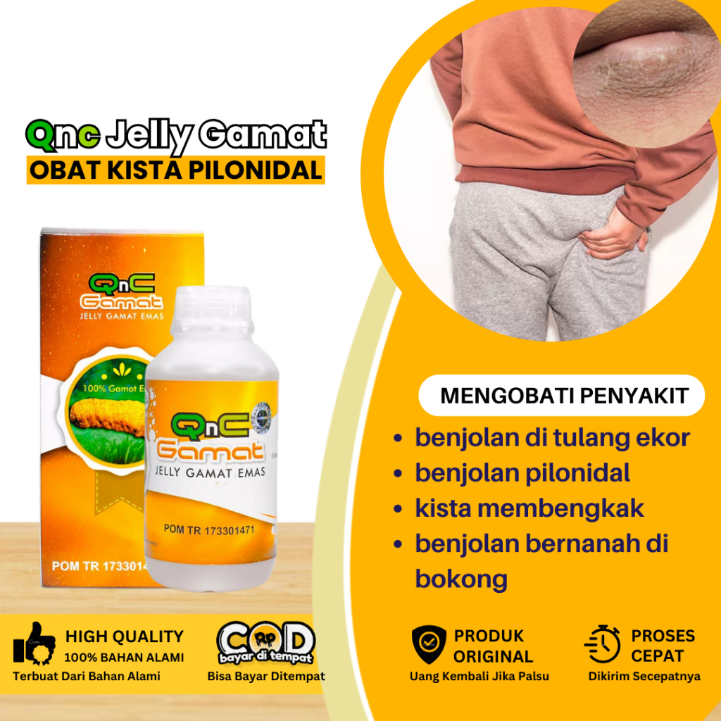 Obat Kista Pilodinal, Obat Penghilang Benjolan Di Tulang Ekor, Obat Benjolan Kista Membengkak, Obat 