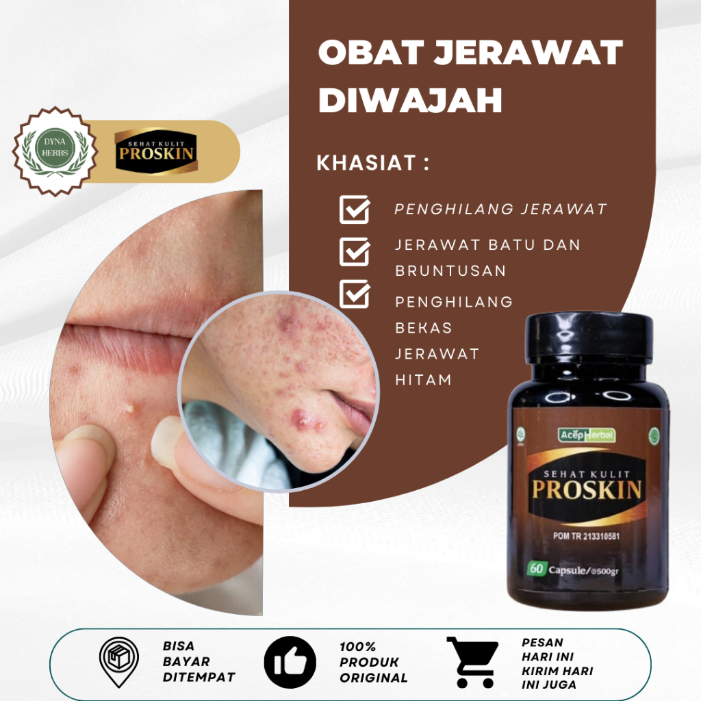 Obat Penghilang Jerawat, Obat Untuk Mengilangkan Bekas Jerawat, Obat Penghilang Bintik Merah, Obat G