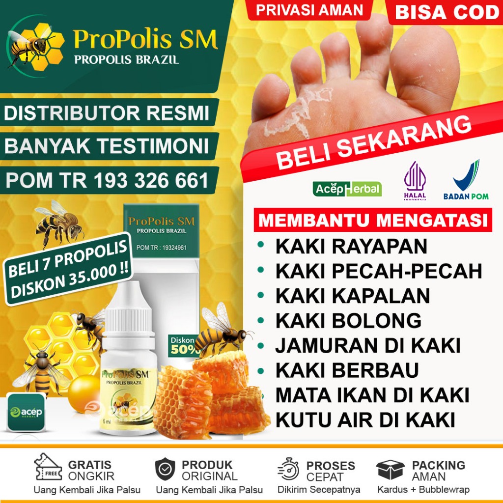 Obat Kaki Rayapan Telapak Kaki Bolong-Bolong Berlubang Cantengan Kutil Kapalan Kaki Pecah Pecah Beng