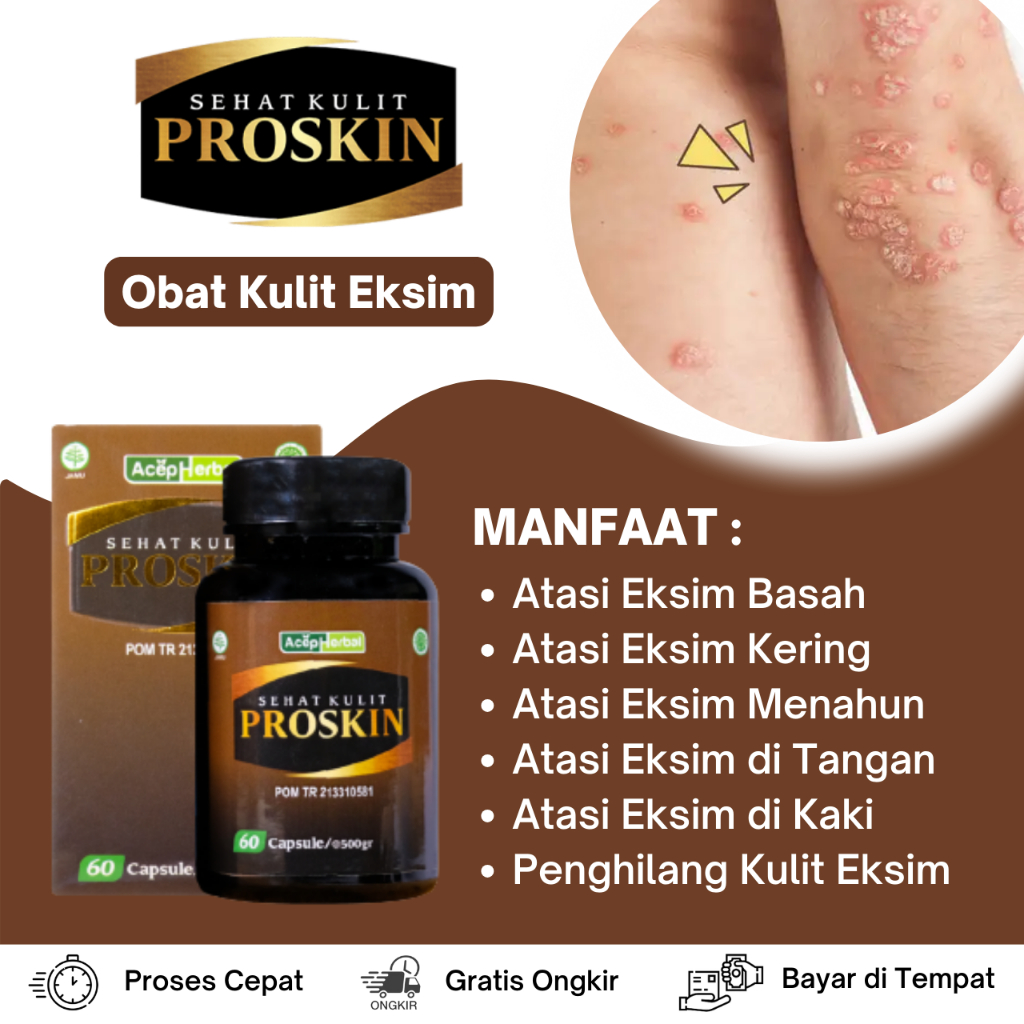 Obat Kulit Eksim, Obat Eksim Basah, Obat Eksim Kering, Obat Eksim Menahun, Obat Infeksi Jamur, Obat 