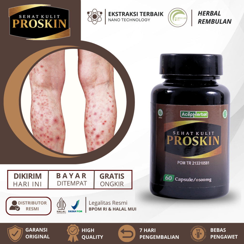 Obat Darah Manis, Obat Prurigo Darah Manis, Obat Koreng Gatal, Obat Gatal Kulit Prurigo, Obat Budug,