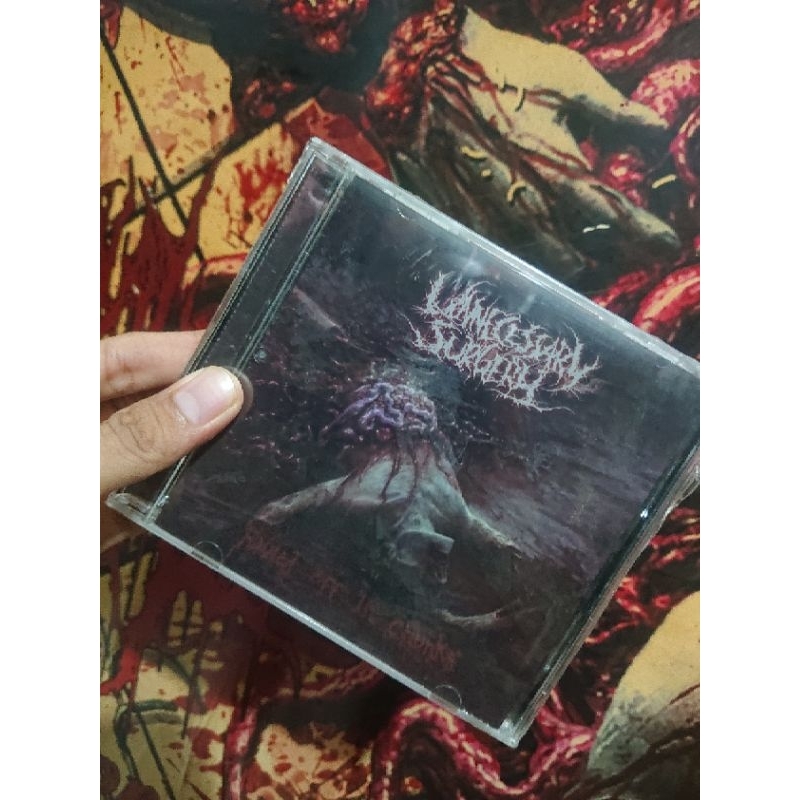 cd unnecessary - surgery
