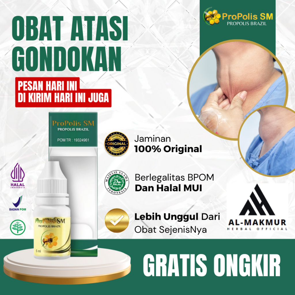 Obat Gondok, Obat Benjolan Di Leher, Obat Penghilang Gondok, Obat Pengecil Gondokan, Obat Kelenjar T
