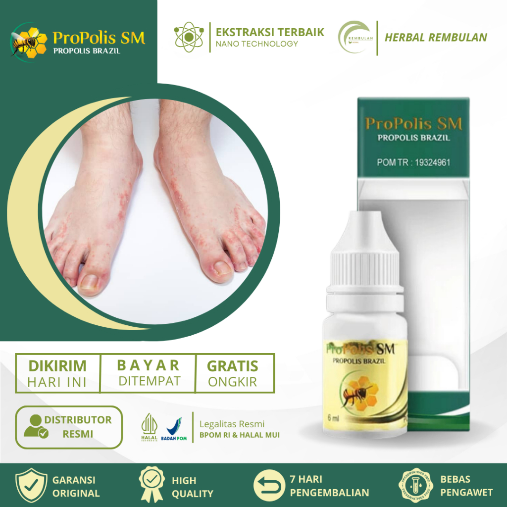 Obat Kutu Air, Obat Kutu Air di Tangan dan Kaki, Obat Penghilang Kuman Air, Obat Kutu Air Di Sela Ja