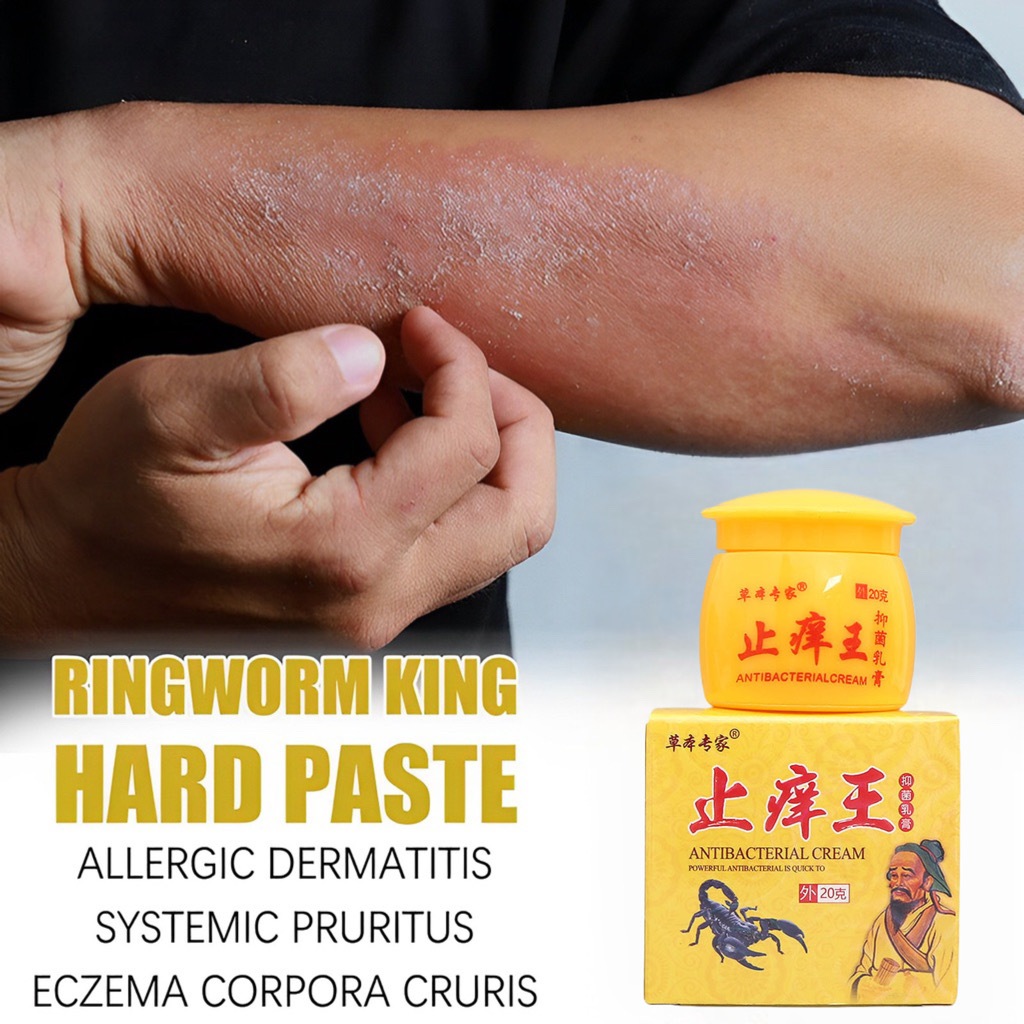 Salep Psoriasis Salep Kulit Krim salep exim ampuh Salep gatal 20G Psoriasis Paling Ampuh Gatal Cream