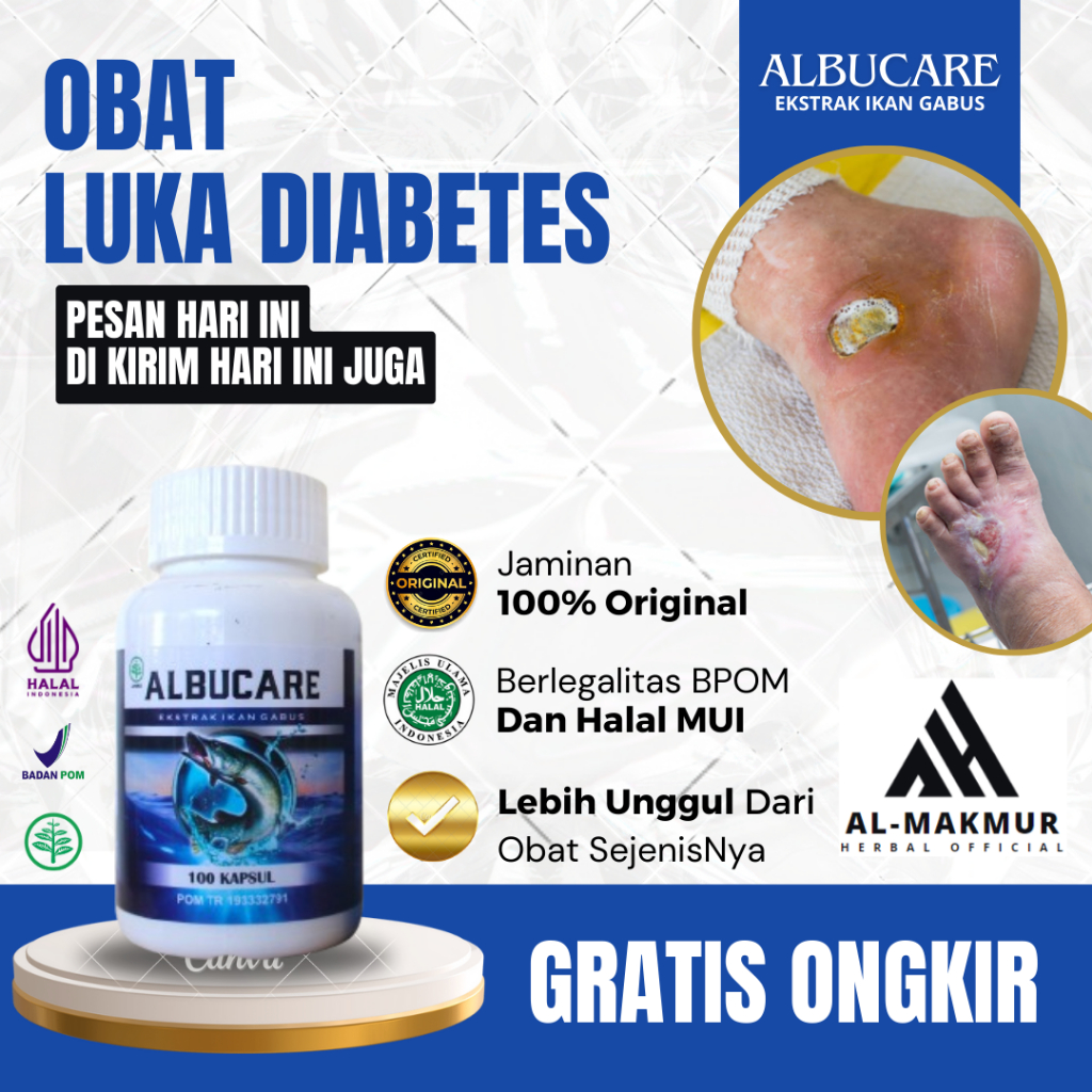 Obat Luka Diabetes, Obat Penering Luka Diabetes, Obat Luka Diabetes Basah Bernanah, Obat Luka Diabet