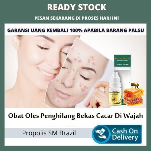 Obat Oles Penghilang Bekas Cacar Di Wajah, Obat Bopeng Bekas Cacar Air, Pengering Cacar Air Berisi A