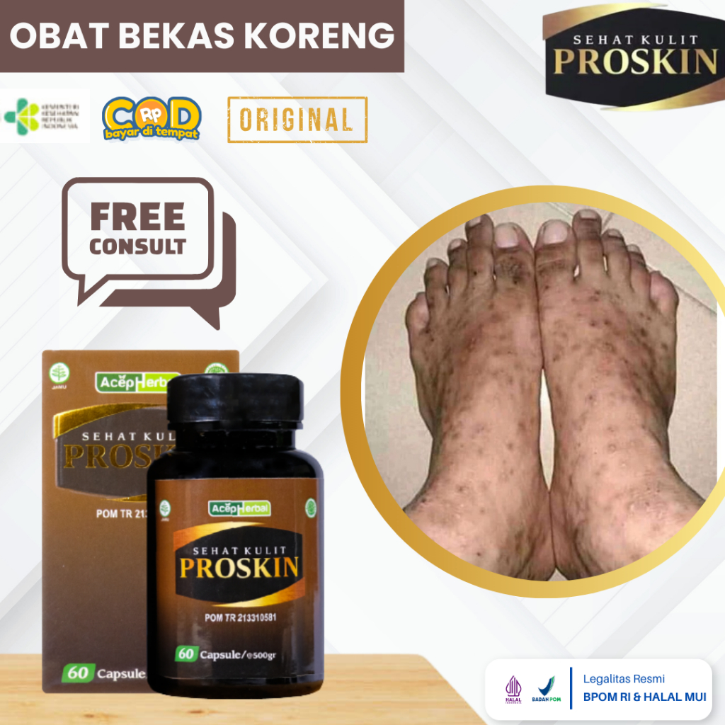 Obat Bekas Luka Koreng Hitam Di Kaki, Obat Penghilang Bekas Koreng, Obat Bekas Luka Lama Hitam, Kore