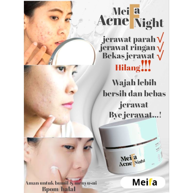 MEIFA Skincare acne night cream  malam menghilangkan jerawat mampu melindungi agar jerawat tidak kem