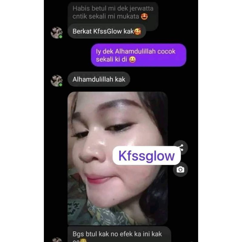 KFs glow