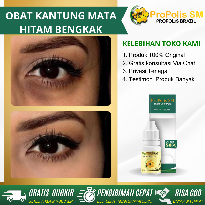 OBAT PENGHILANG KANTUNG MATA PANDA HITAM DAN KERUTAN OBAT TETES MENGHILANGKAN MATA PANDA PENGHILANG 