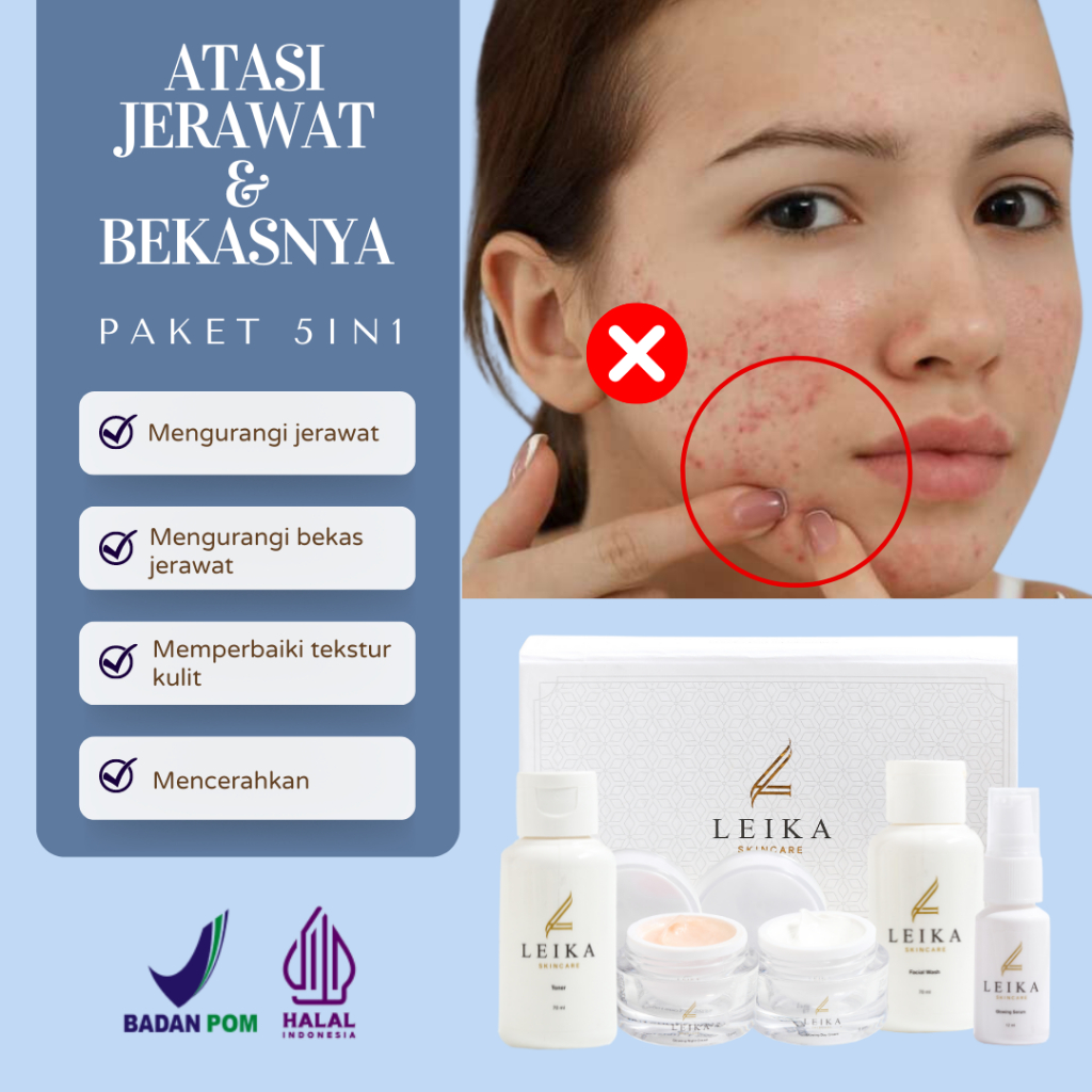 [PAKET 5in1 Jerawat Dan Bekasnya] Penghilang Jerawat Dan Bekas Jerawat Bpom Krim Jerawat Ampuh Pengh