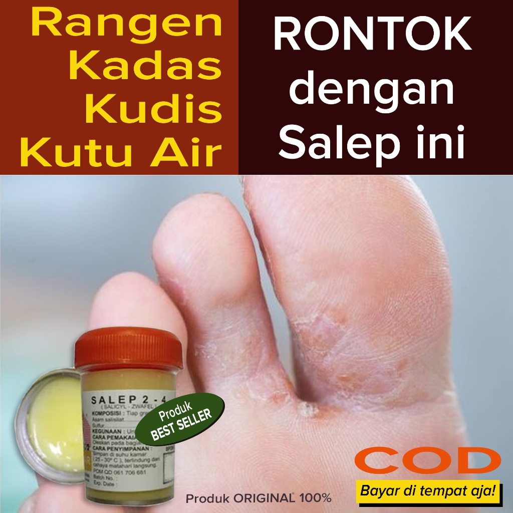 Salep obat rangen kudis kadas panu kutu air eksim gatal sela sela Jari gatal kuman telapak kaki dan 