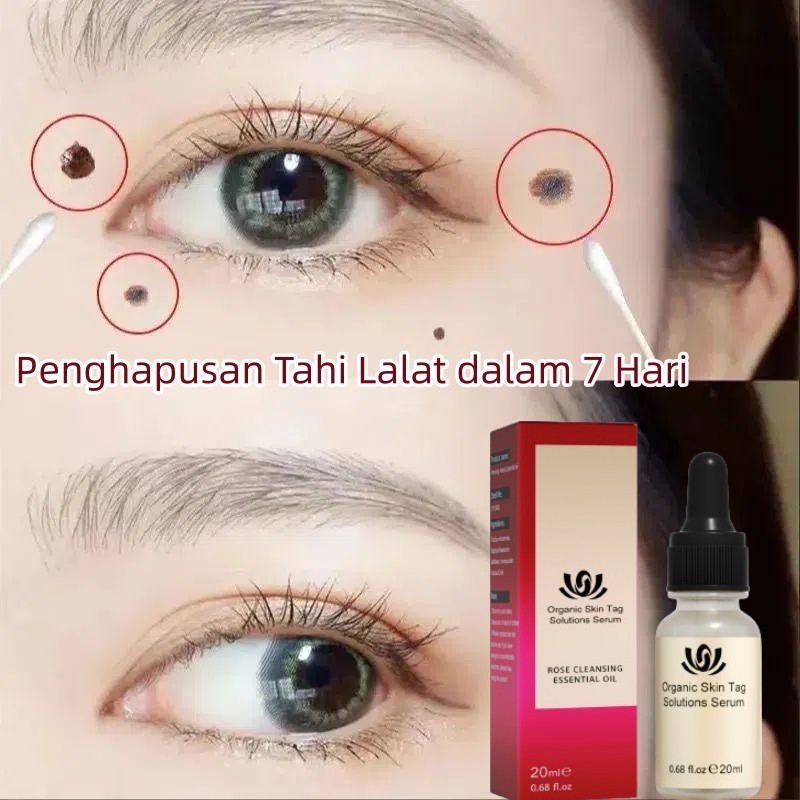 Penghilang Tahi Lalat Penghilang Kutil Skin Tag Remover Serum Penghilang Tahi Lalat Wart Remover pen