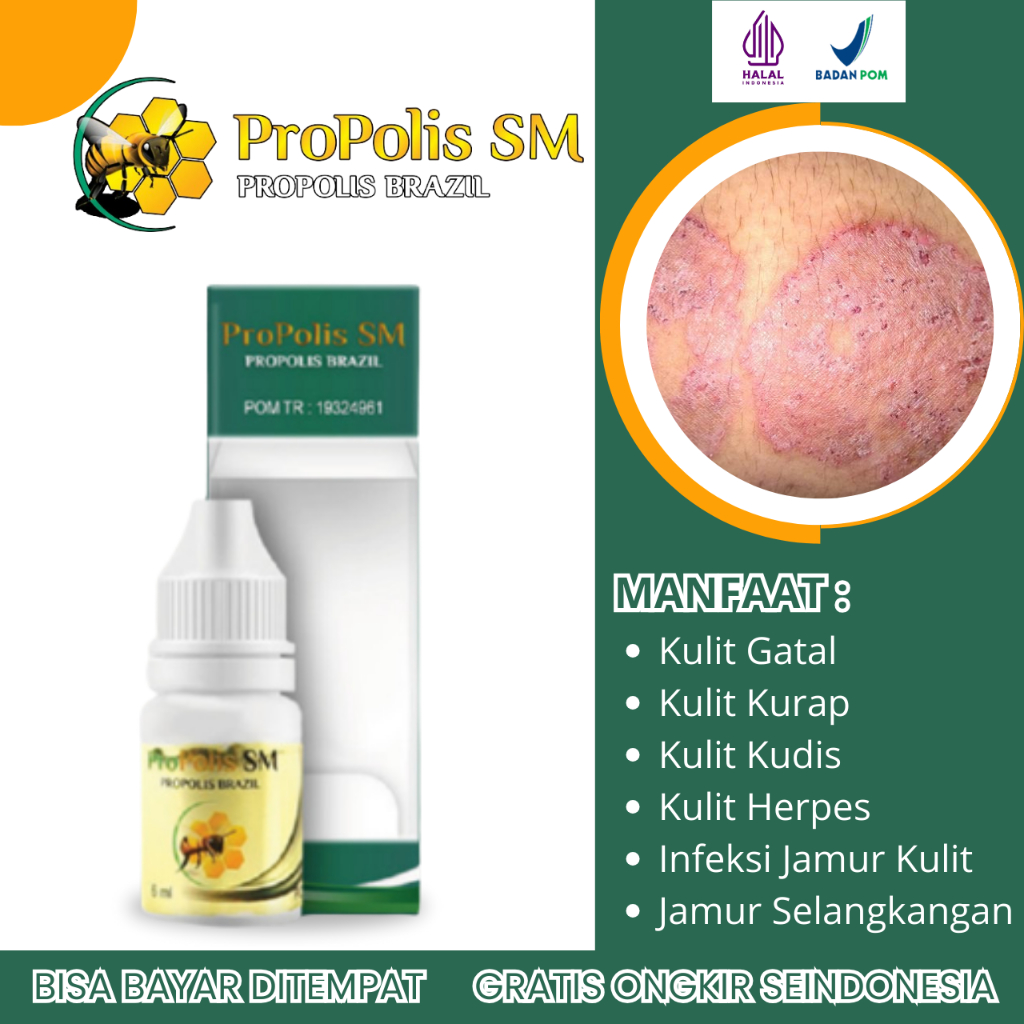 Obat Kulit Gatal, Obat Gatal Jamur, Obat Kulit Kudis, Obat Kulit Kurap, Obat Kulit Berair, Obat Kuli