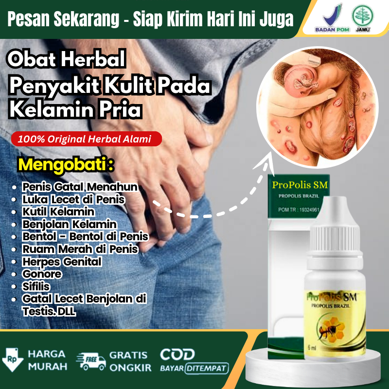 Obat Kutil Kelamin Obat Tumbuh Daging di Area Kemaluan Pria Obat Skintag di Penis Obat Oles Benjolan