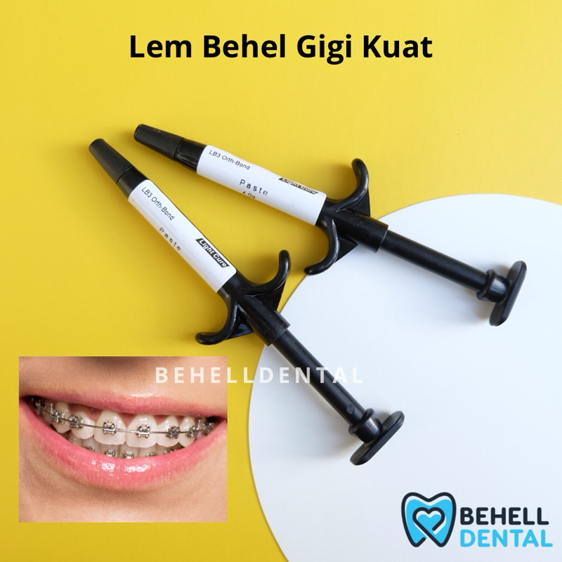 7vawaskatun - lem pasta orthobonding - lem behel gigi laser curing light cure - lem kawat gigi