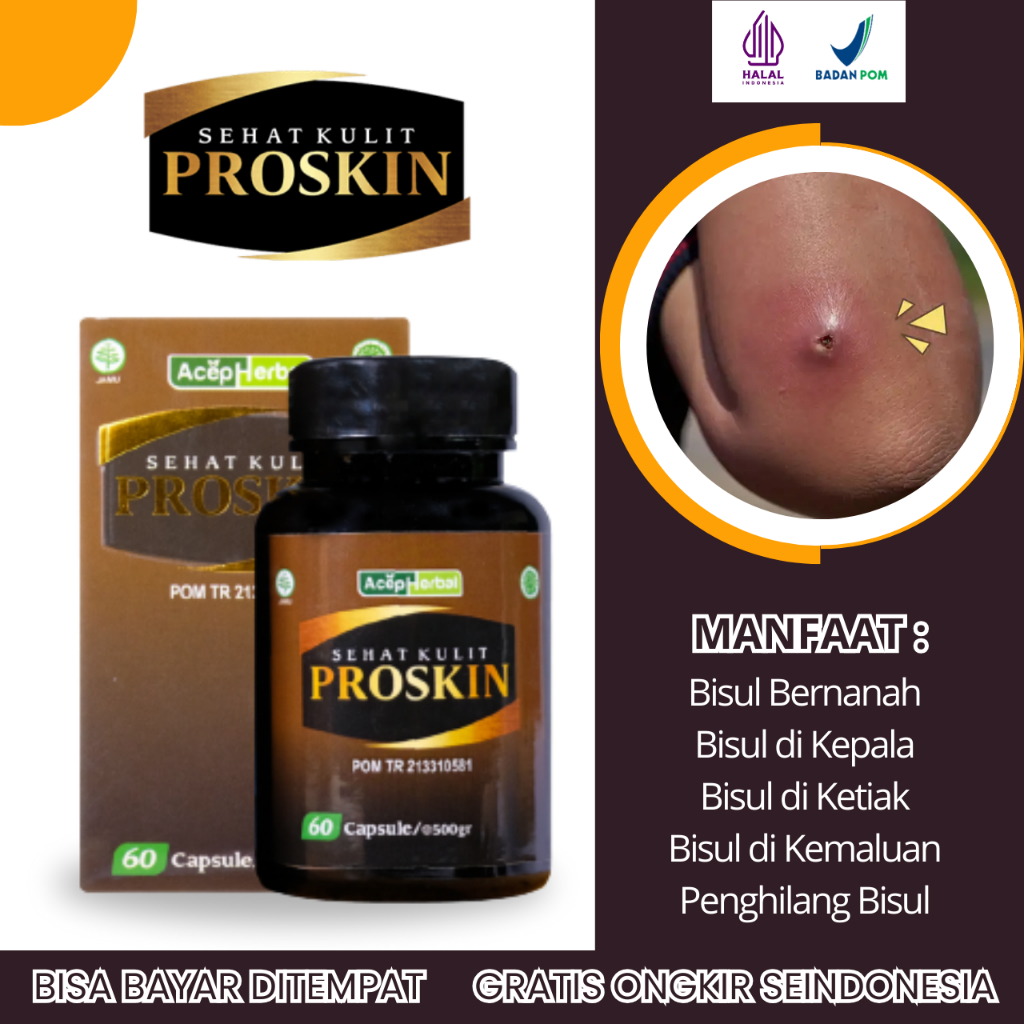 Obat Bisul Bernanah, Obat Bisul di Kepala, Obat Bisul di Dalam Telinga, Obat Bisul di Punggung, Obat