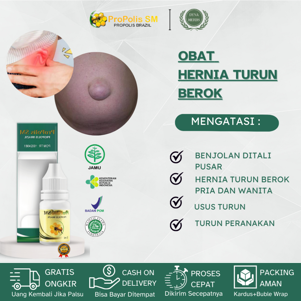 Obat Hernia Turun Berok, Obat Hidrokel Testis Besar, Obat Buah Zakar Bengkak, Obat Benjolan Varikoke
