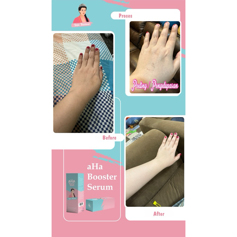 RATU THAILAND Booster Whitening Chemical Peeling Solution- Serum Exfoliating Dark Spot Eksfoliasi Wa