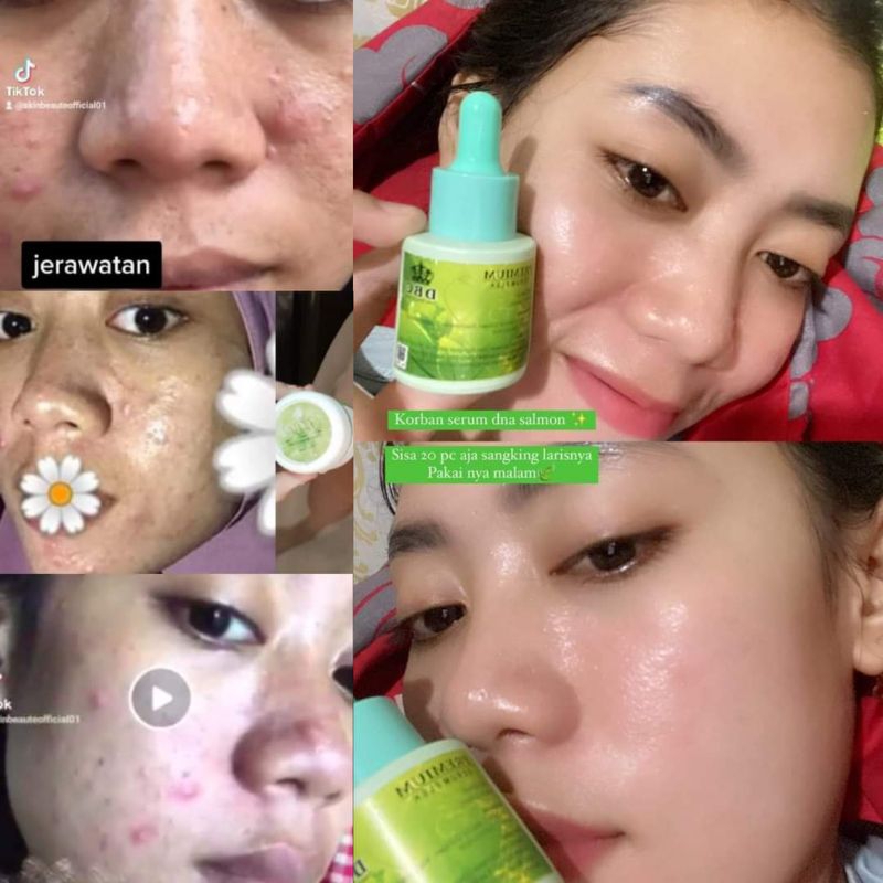 Serum DNA Salmon DBC