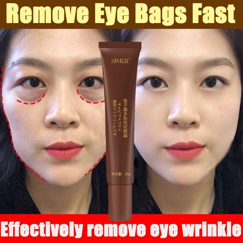 Krim Penghilang Lingkaran Hitam Caviar Krim Penghilang keriput Mata Krim Penghilang Kantung Mata Men