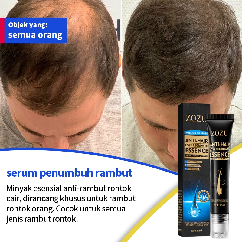 NEW PORODUK SERUM PENUMBUH RAMBUT OBAT PENUMBUH RAMBUT PENUMBUH RAMBUT BOTAK SERUM PENUMBUH RAMBUT