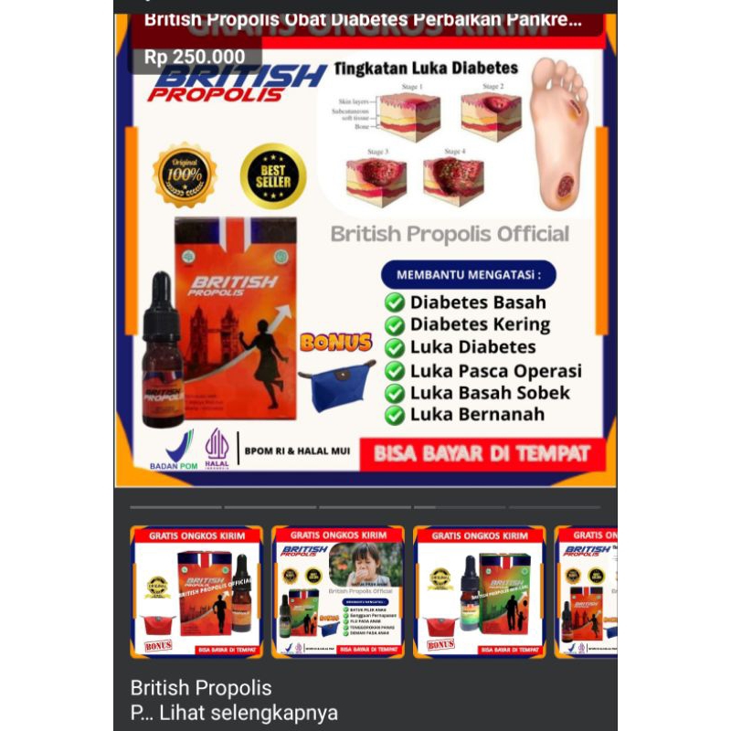 British propolis NETRO