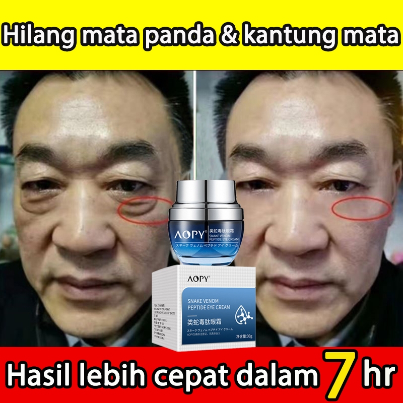 AOPY Eye Cream -Skincare Anti Aging Krim Mata Untuk Kerutan Di Bawah Mata-Cream Mata Panda dan Kerip