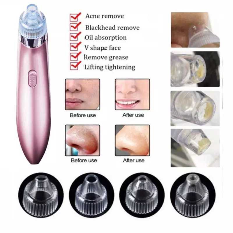 SPONTAN Alat Penyedot Komedo Dan Jerawat CW 666 Beautiful Skin Care ExpertAlat Penyedot Komedo Dan J