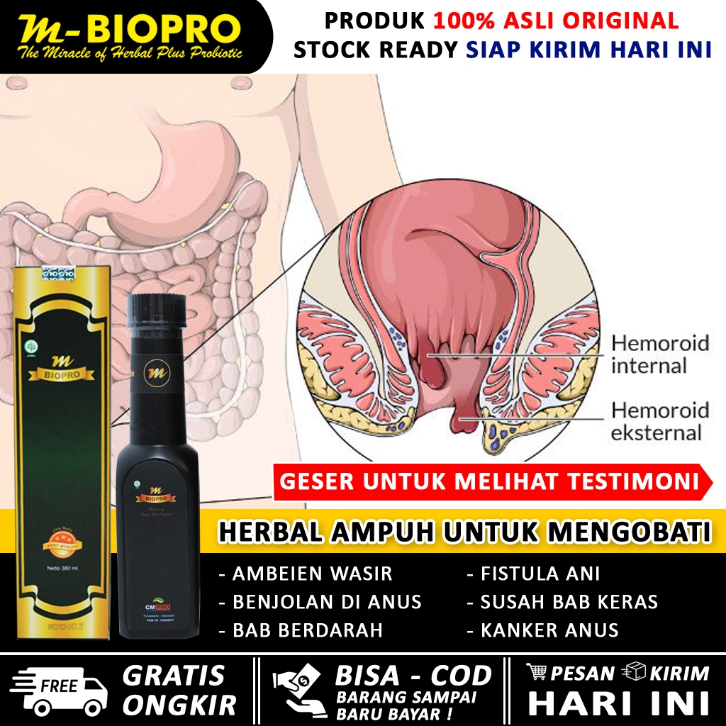 Obat ambeien wasir paling ampuh MBIOPRO - ambeien  superhoid - ambeien madu - ambeien ambeven - benj