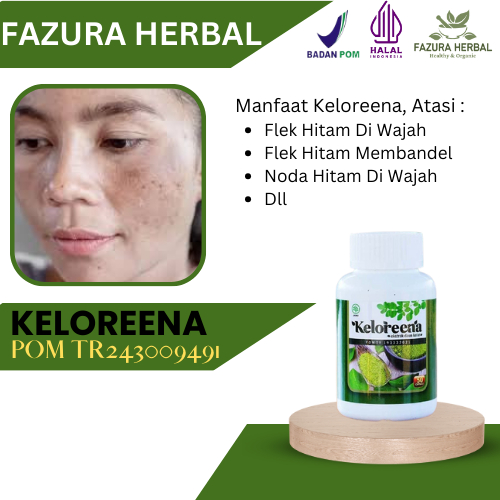 Keloreena - Obat Flek Hitam, Obat Penghilang Flek Hitam, Obat Pemudar Flek Hitam, Obat Flek Hitam Me