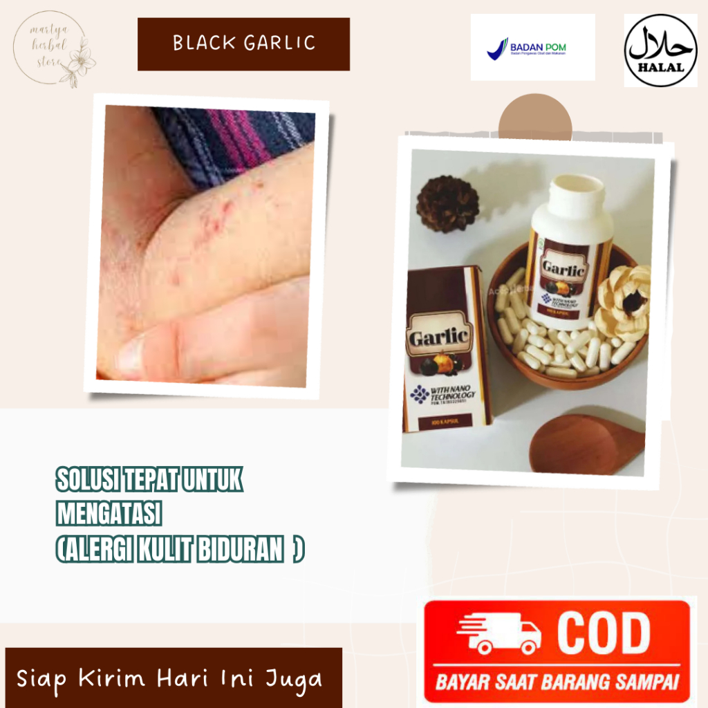 Obat Alergi Obat Alergi Menahun Obat Alergi Gatal Kulit Obat Gatal Biduran , Obat Gatal Kaligata  Ob