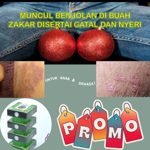 TERBARU! Obat Gatal Biji Pelir, Obat Gatal Buah Zakar Pria, Obat Bentol Di Buah Zakar/Jakar Pria, Ob