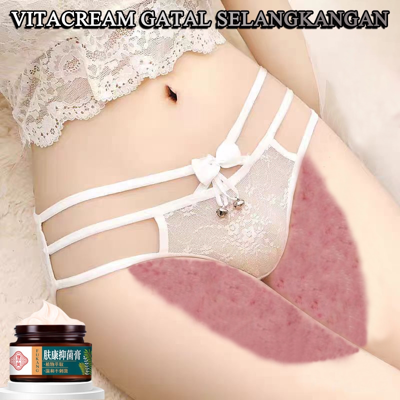 Obat gatal selangkangan vitacream gatal selangkangan salep gatal selangkangan 30g salep kulit gatal 