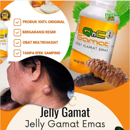 Obat Kista Epidermoid / Penghilang Kista Kulit / Di Daun Telinga / Leher / Kaki - Tangan | GAMAT QNC